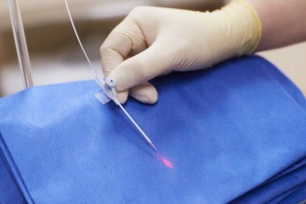 Dans certains cas, la thérapie au laser est utilisée pour traiter la prostatite chronique. 