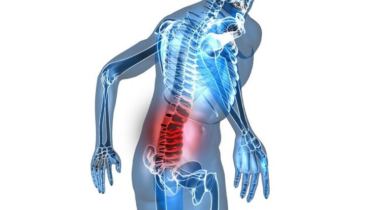 Inflammation avec prostatite congestive.
